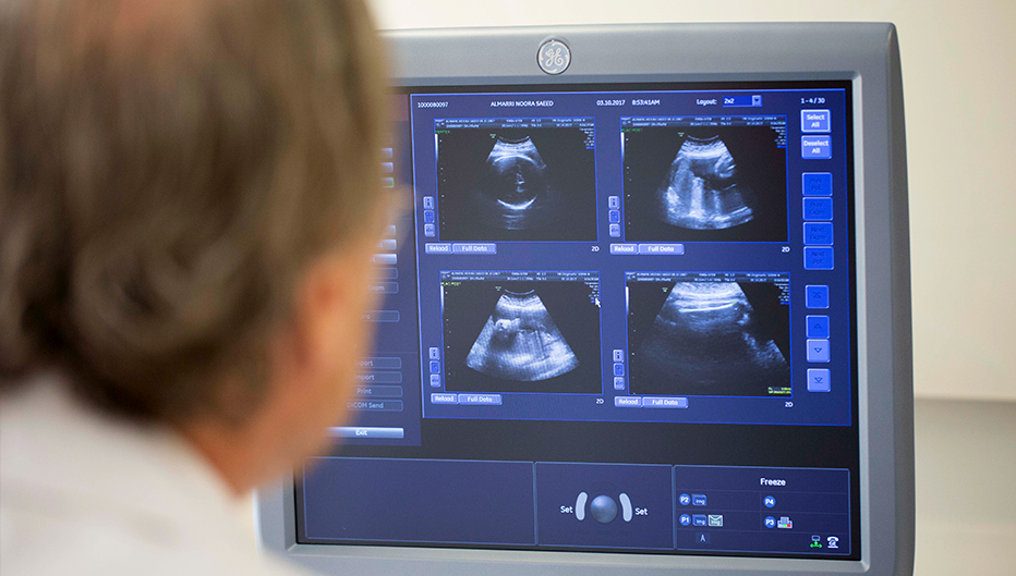 Fetal Imaging